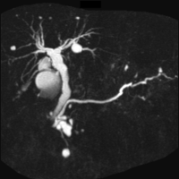 MRCP-MIP